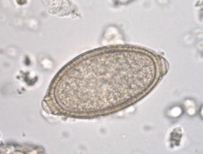 <p>What is the common name of this parasite?</p><p>What can this be mistaken for?</p><p>Besides a <span>cystocentesis what test can be done?</span></p>