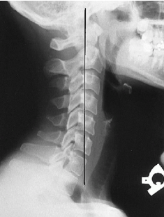 <p>Q what is the name of this measurement? and what is the average + range?</p>