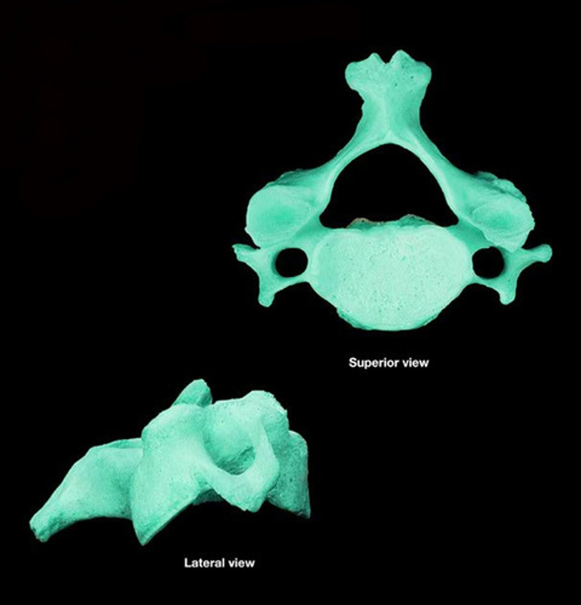 <p>cervical vertebrae</p>