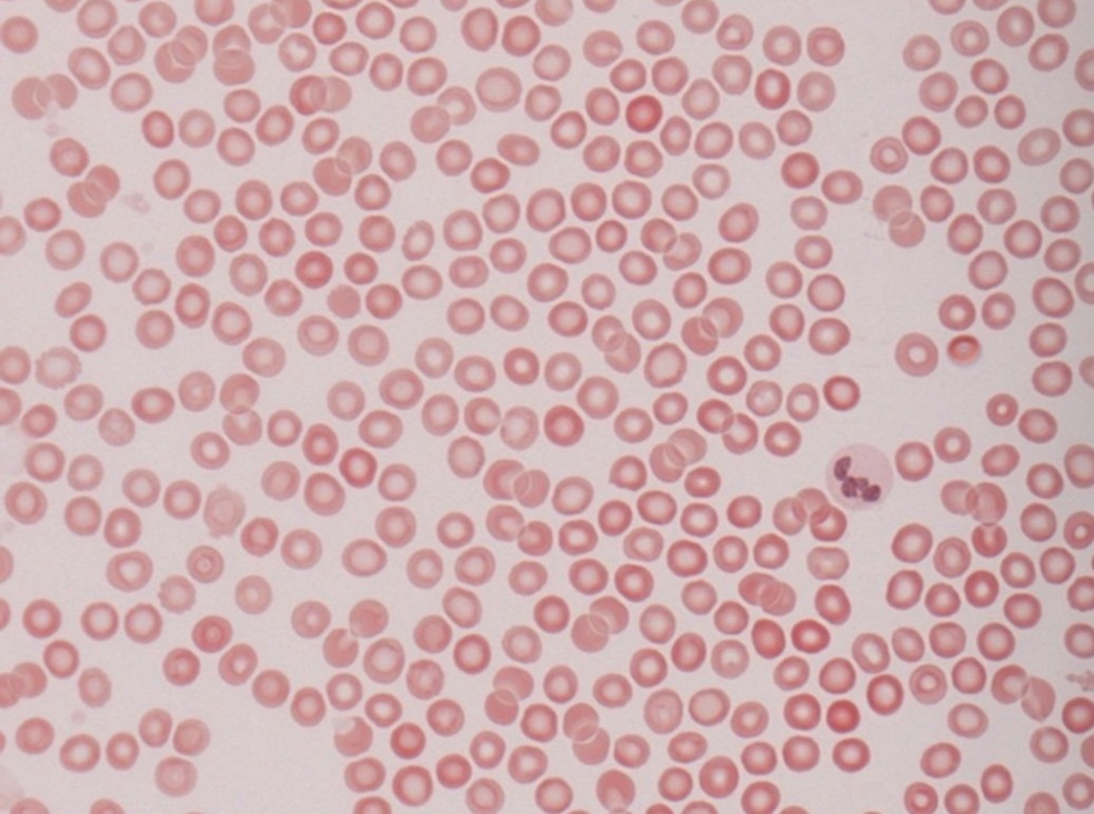 <ul><li><p>eritrocitai</p></li><li><p>Leikocitai</p></li><li><p>Kraujo ploksteles nera lasteles, ju vadinti trombocitais negalim, jos yra citoplazmos atplaisos</p></li></ul><p></p>