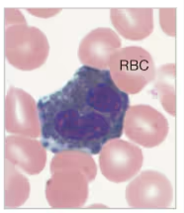 <p>What White Blood Cell is being displayed?</p>