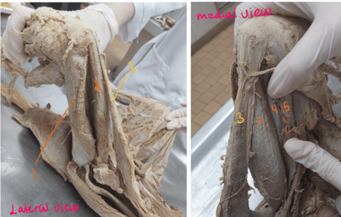<p>identify structures. what muscle do the orange structure make up?</p>
