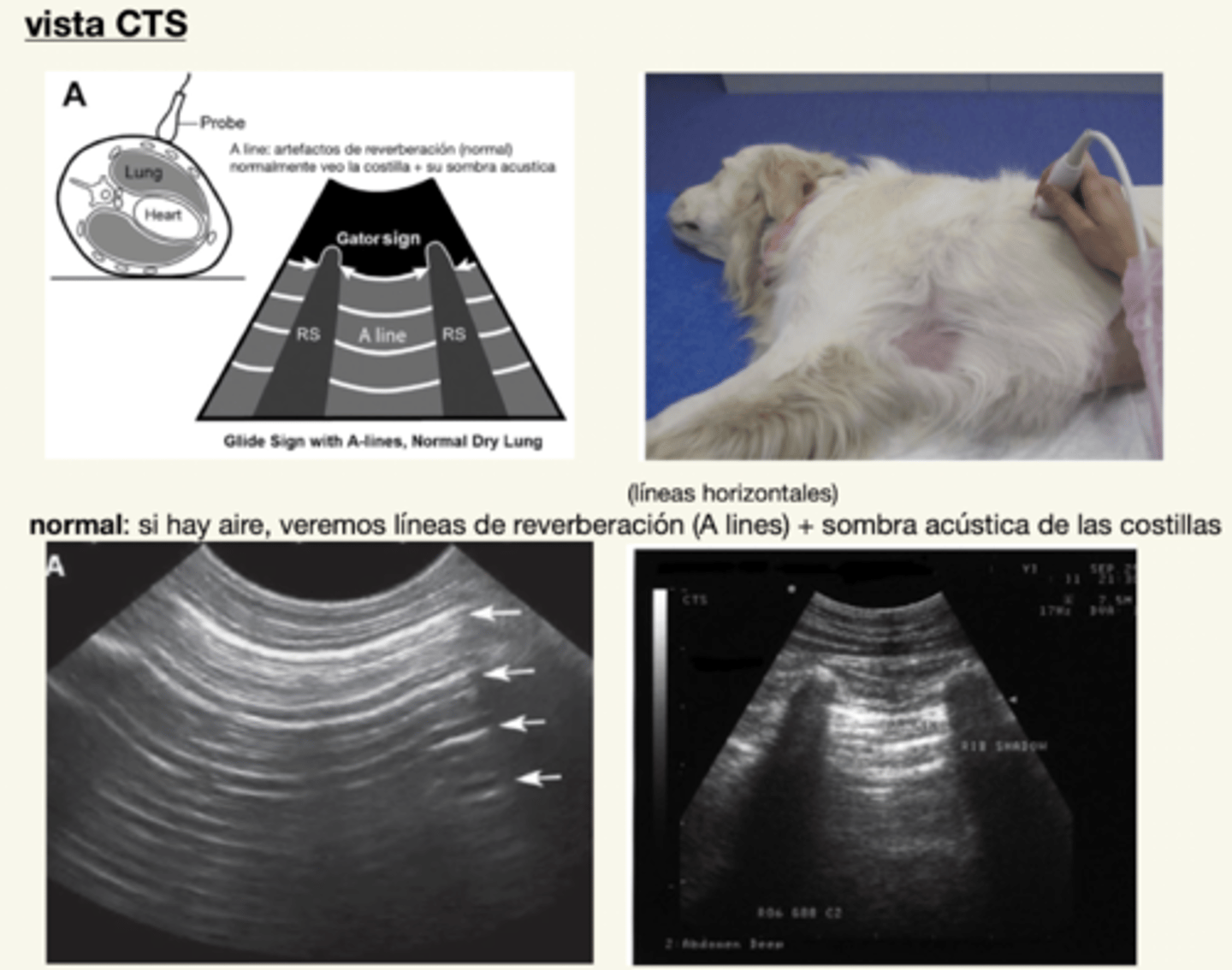 <p>neumotórax</p><p>derrame pulmonar</p>