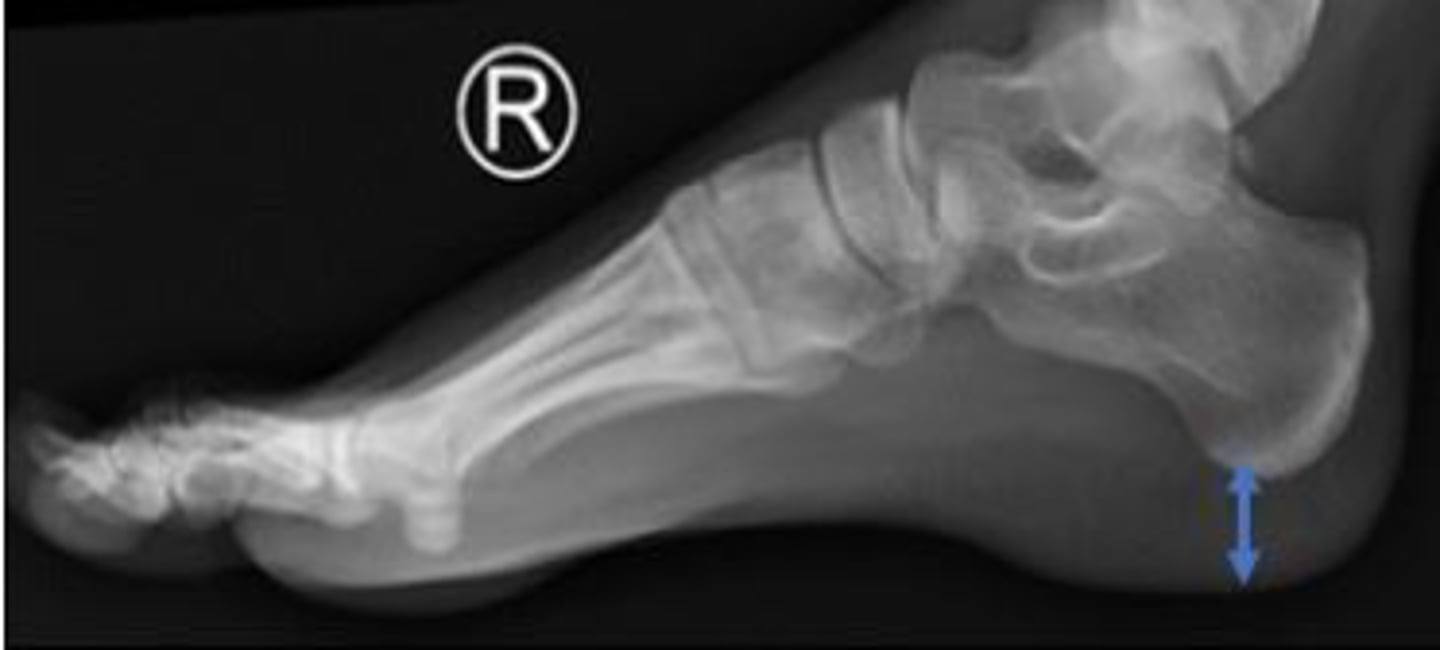 <p>What are the arrows pointing to?</p>