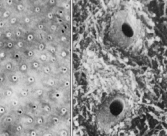 <p>what type of dentin is immediately around dentinal tubules</p>