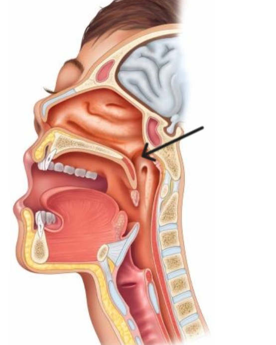 <p>The structure highlighted is </p>