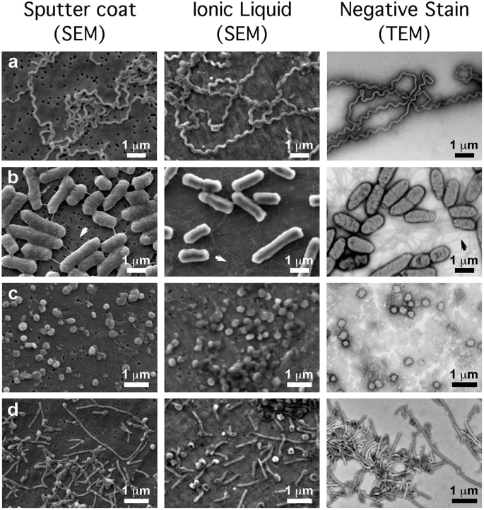 <ul><li><p>Best for</p><ul><li><p>observing the internal ultrastructure of cells, organelles , and biomolecules at very high resolution (nm)</p></li><li><p>Ex. studying the texture and surface features of bacterial bio films</p></li></ul></li><li><p>Why? </p><ul><li><p>provides detailed surface imaging with high depth of field</p></li></ul></li></ul><p></p>