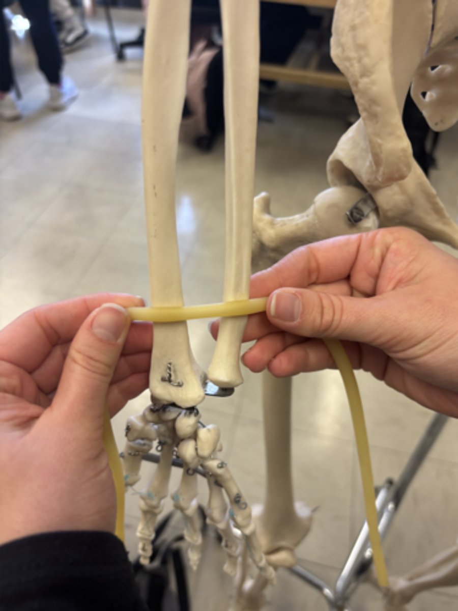 <p>What is this muscle?</p>