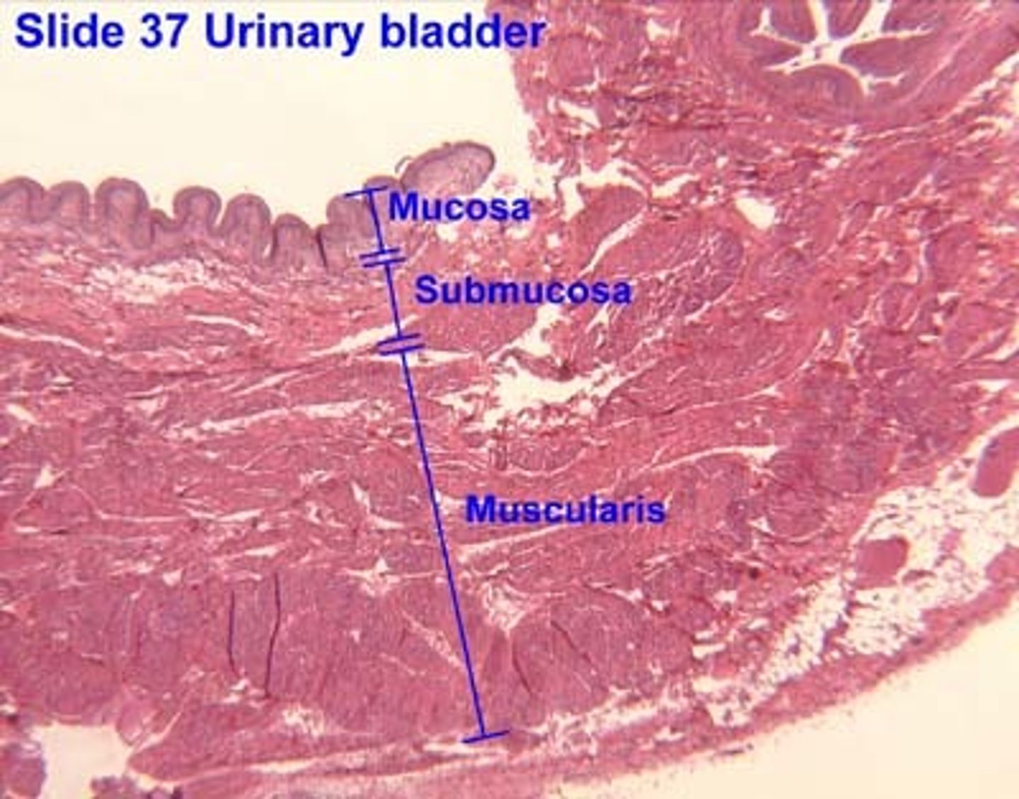 <p>Transitional epithelium forming rugae</p>
