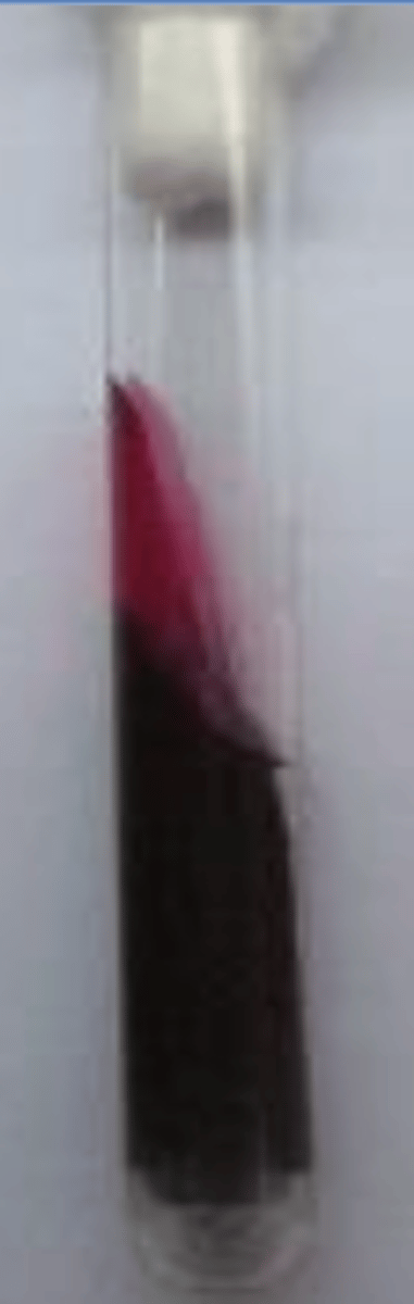 <p>which genus in family Enterobacteriaceae produces this TSI result?</p>