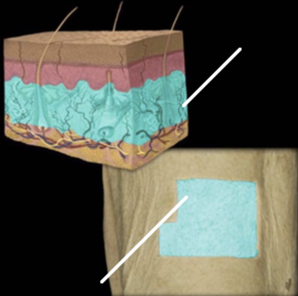 <p>Dermis</p>
