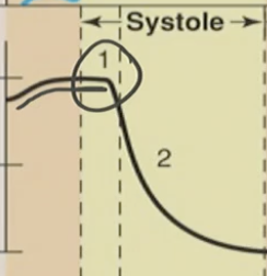 <p><strong>What is occurring here? </strong></p><p>Relaxation?</p><p>Contraction?</p><p><strong>Also what is the <u>special</u> name for this?</strong></p>