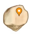<p>What part of the patella is this?</p>