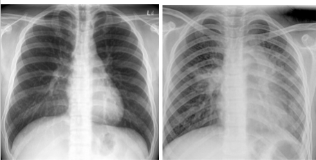 <p>whats the dx for these pics?</p>