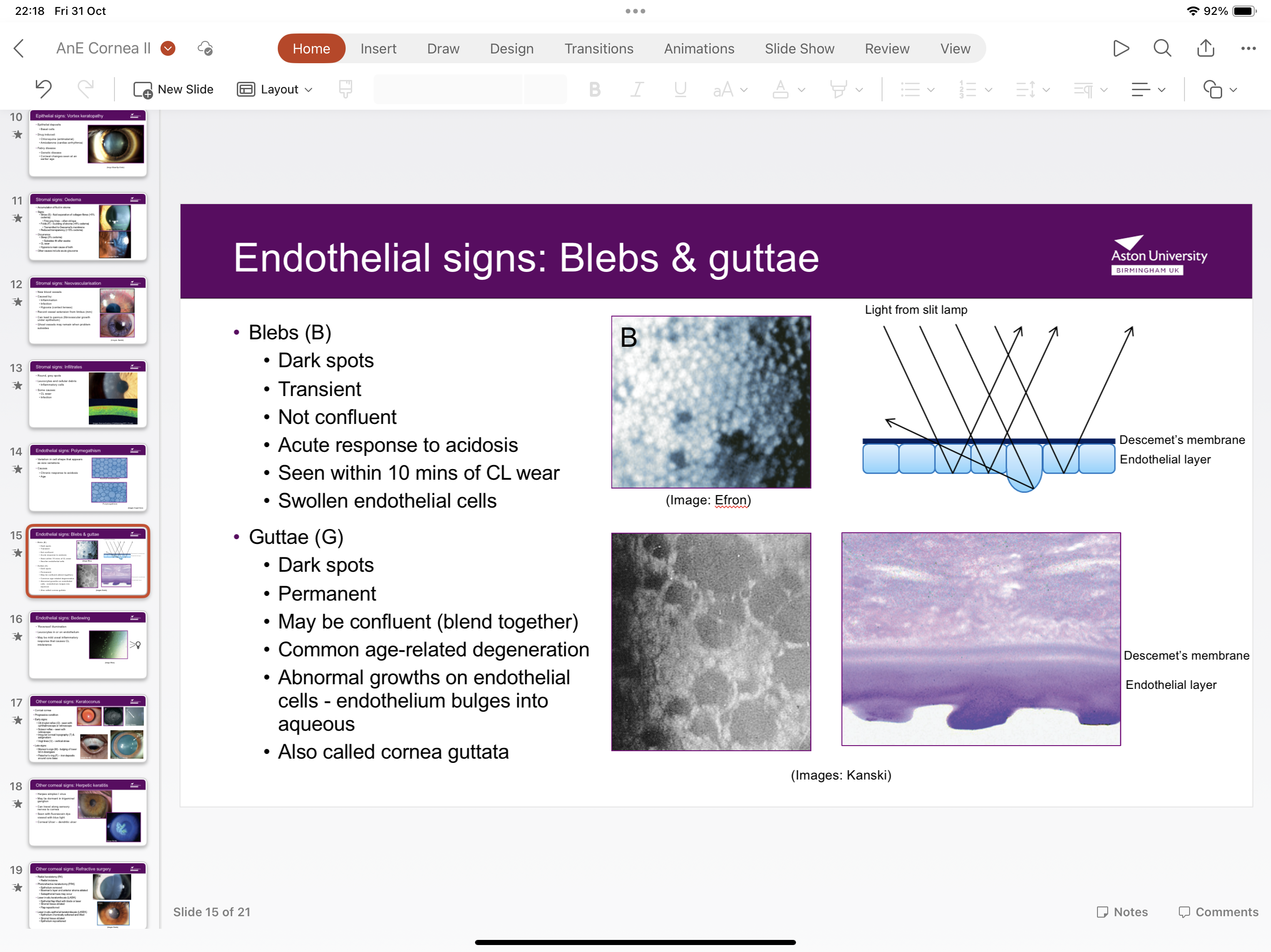 <p>Permanent dark spots which may be confluent (blend together) caused by abnormal growths on endothelial cells endothelium bulges into aqueous- age related</p>