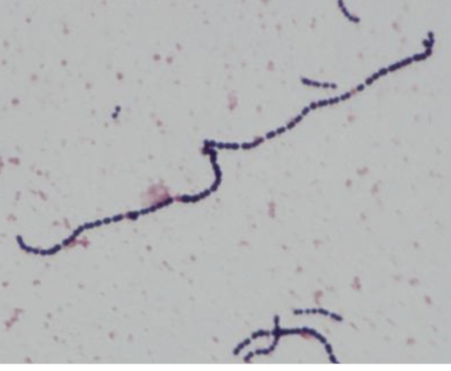 <p>what bacteria?</p>