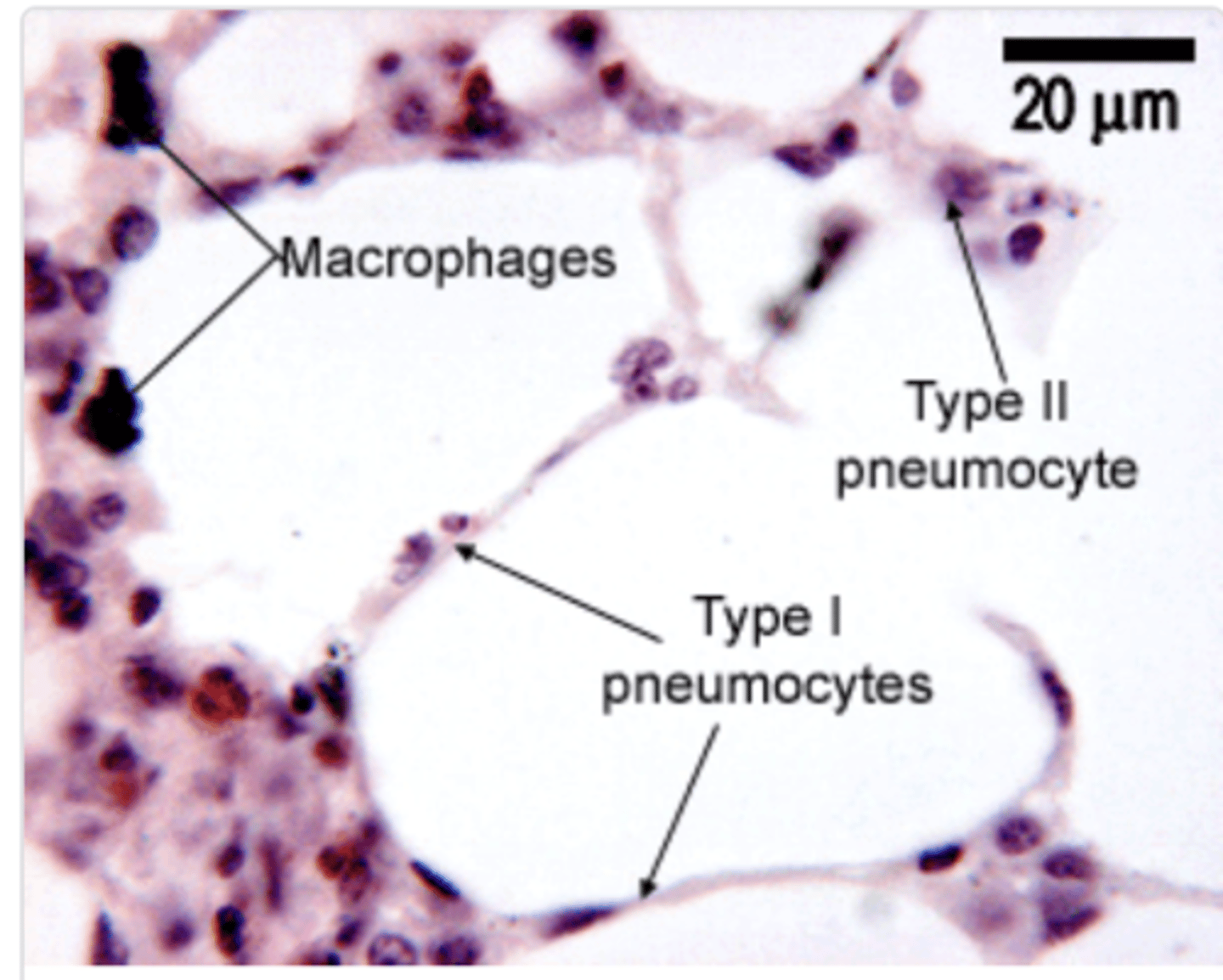 <p>simple squamous epithelial cells and cover the majority of the</p><p>alveolar surface (97%).</p>