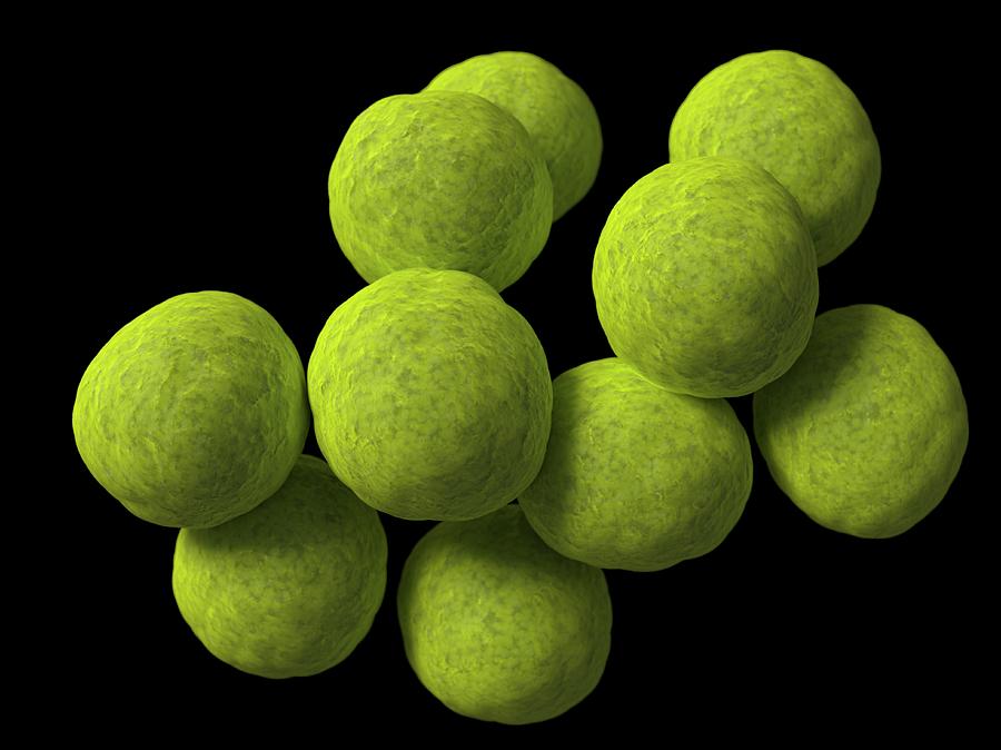 <p>Spheres </p>