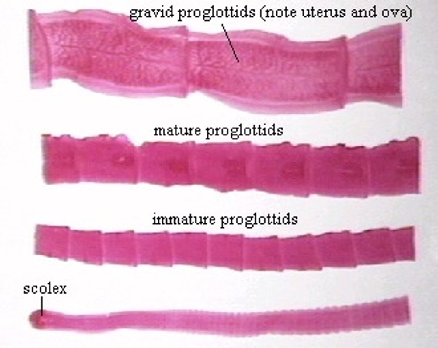 <p>tapeworms</p>