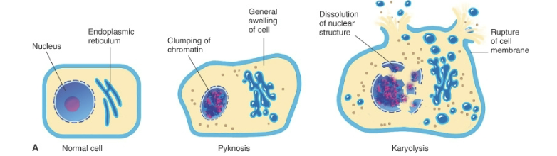 <p>Basophilia of the chromatin may fade, a change that presumably reflects DNAase activity</p>