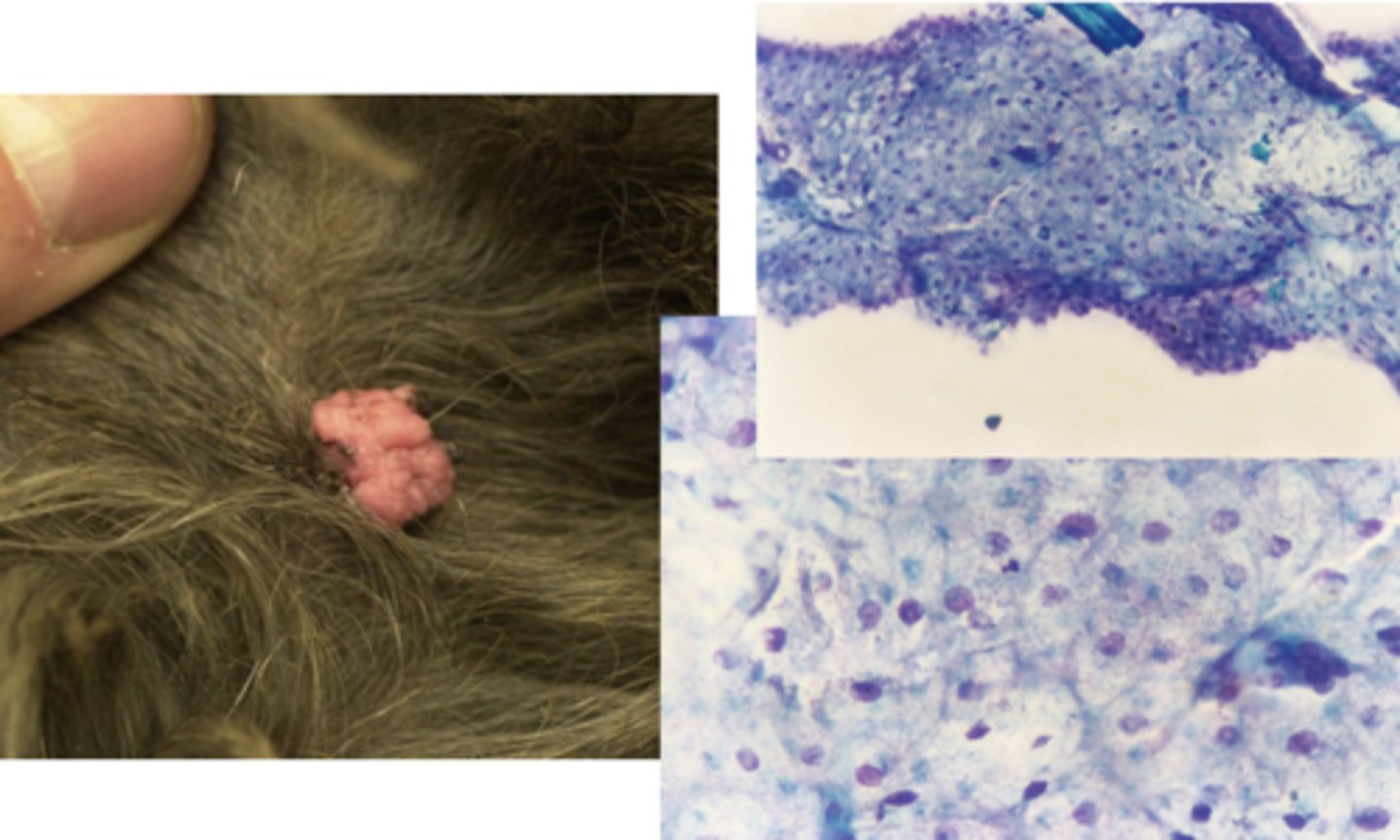 <p>What type of tumor is this?</p>