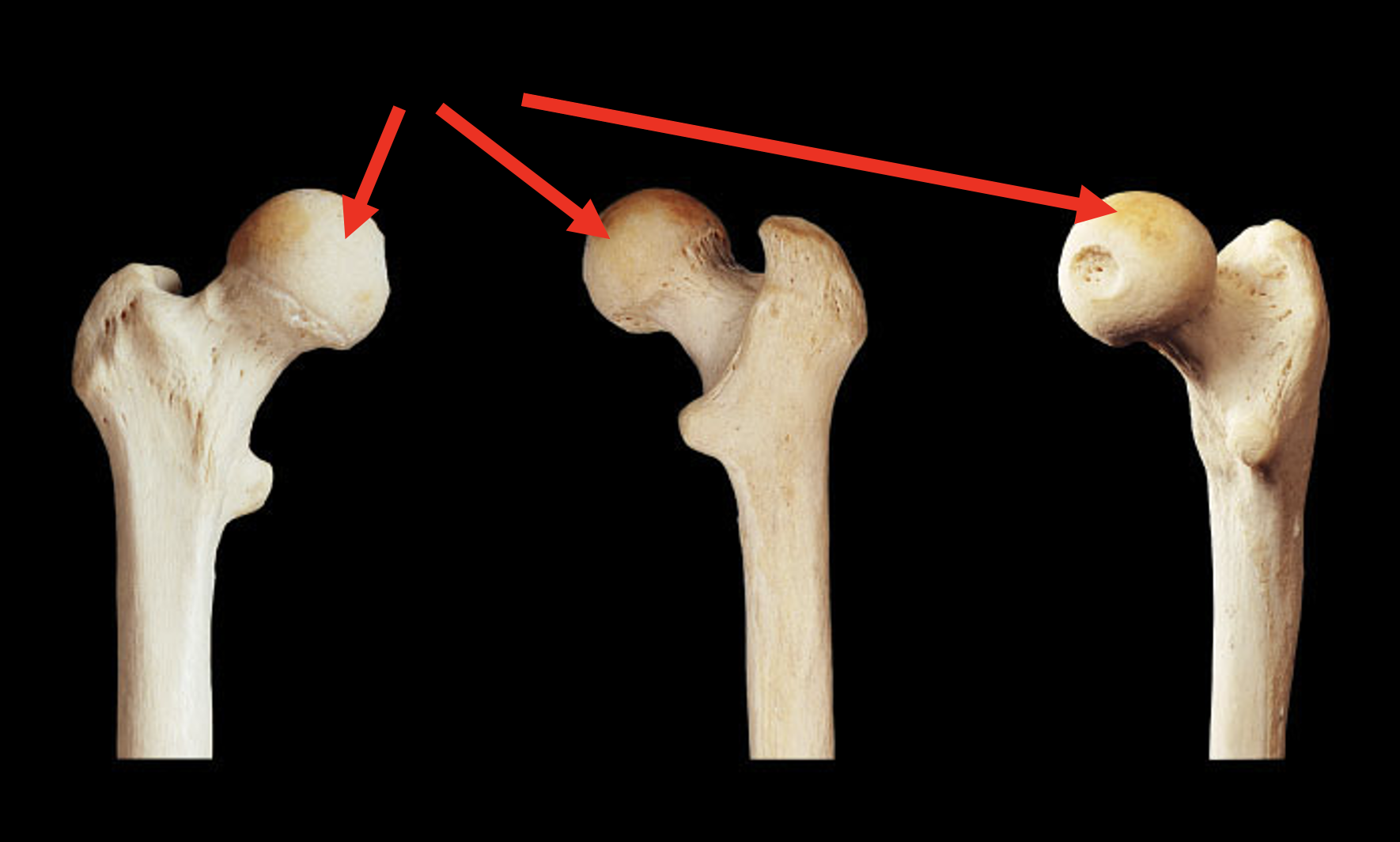 <p>Name this region of the femur</p>