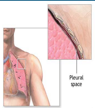 * Thin space between visceral and parietal pleura 
* Small amount of pleural fluid to keep the layers in contact and provide lubrication 
* Must have slight negative pressure (vacuum created by lymph) 
* Keeps lungs inflated and able to follow thoracic wall during inspiration and expiration 