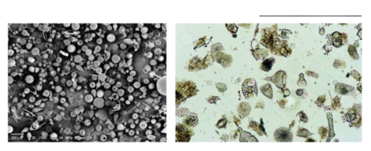 <p>What is the PHYLUM of the organism pictured?</p>