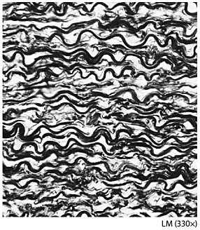 <p><span style="font-family: Lato Extended, Lato, Helvetica Neue, Helvetica, Arial, sans-serif">What fibers are common in this tissue?</span></p>