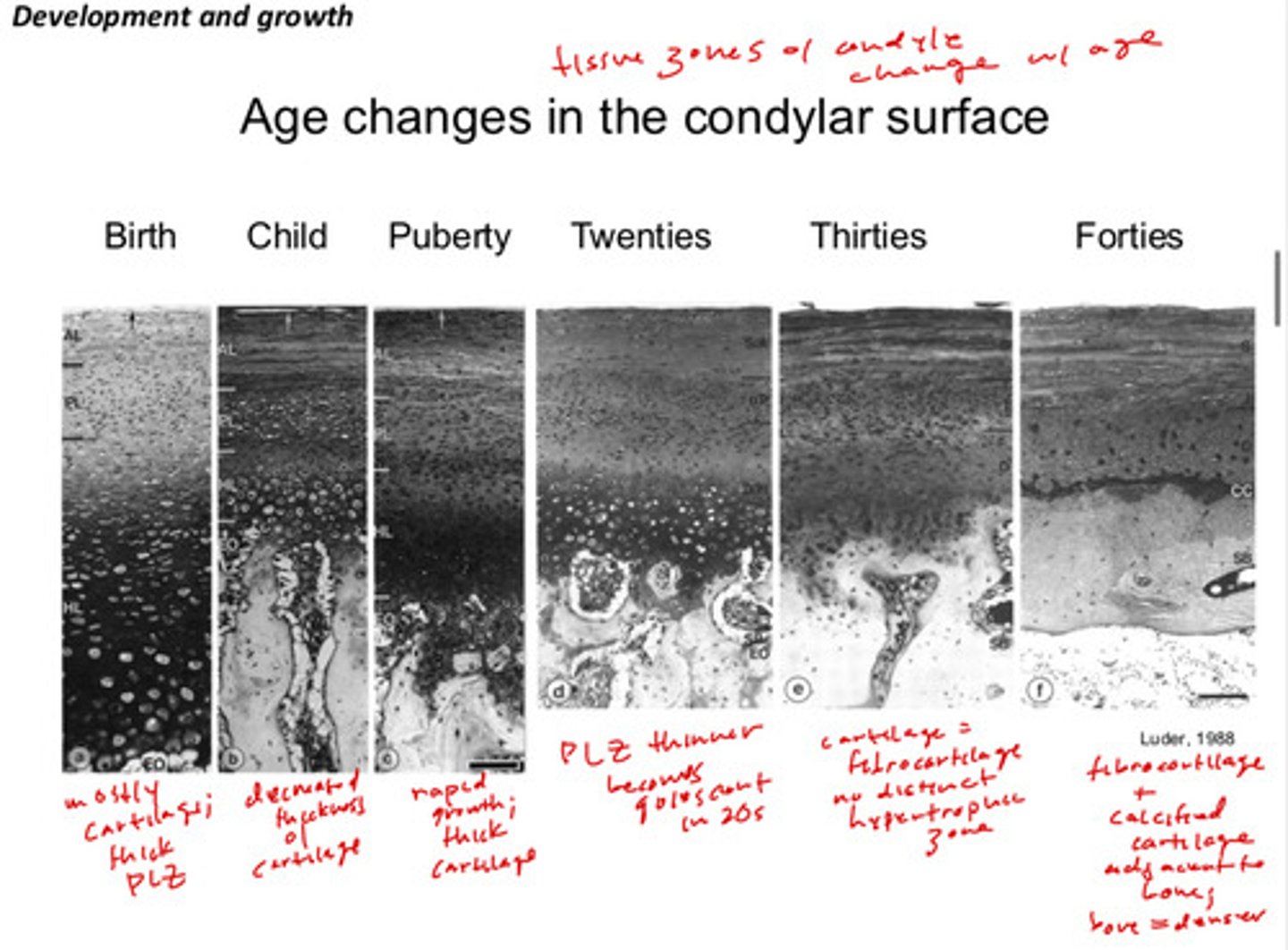 <p>at birth: mostly cartilage, thick proliferative zones</p><p>child: decrease of thickness of cartilage</p><p>puberty: rapid growth; thick cartilage again</p><p>twenties: proliferative zones becomes thinner and quiescent</p><p>thirties: cartilage transitions to more fibrocartilage; there is no distinct hypertrophic zone at this point</p><p>forties: distinct fibrocartilage + calcified cartilage adjacent to the bones; bone is also denser</p>