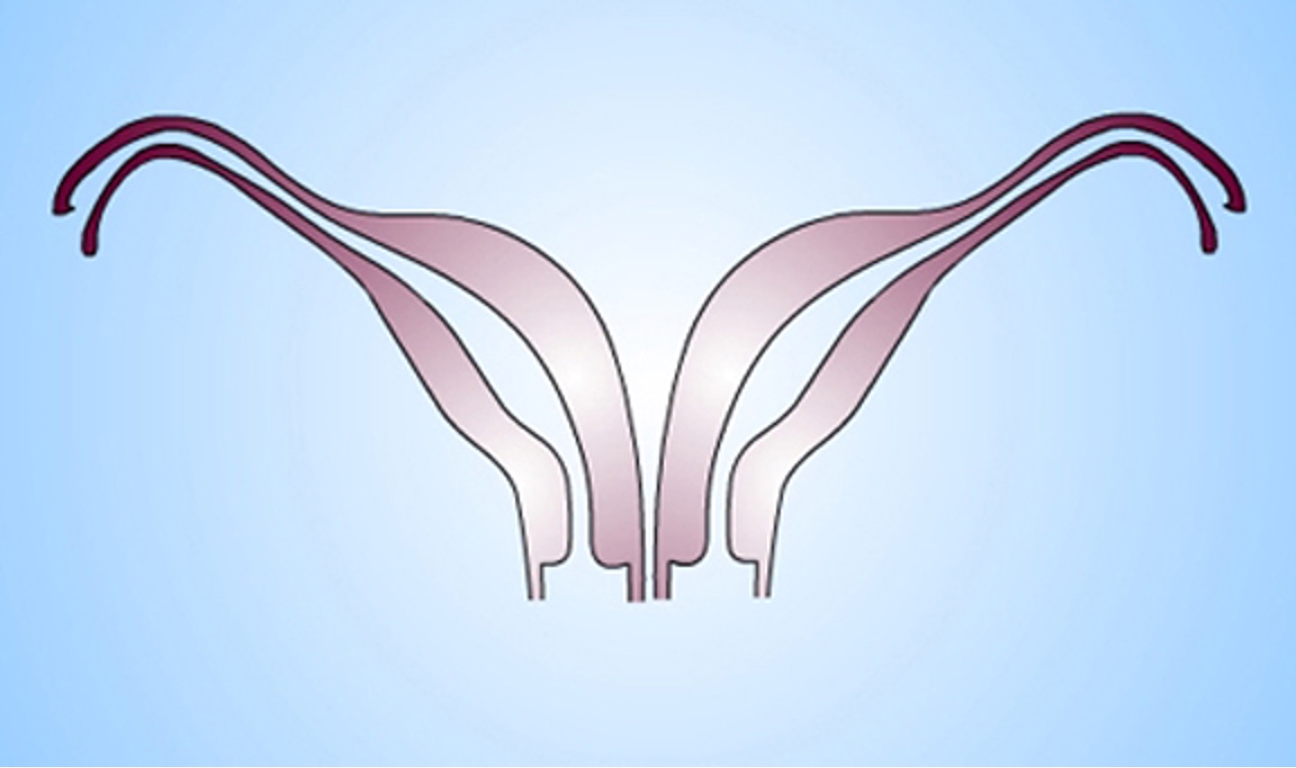 <p>What class mullerian defect is this?</p><ul><li><p><strong>didelphys uterus</strong> → results from complete confusion of both ducts</p></li><li><p>individual horns are fully developed and almost normal in size</p></li><li><p>2 cervices inevitably present</p></li><li><p>longitudinal or transverse vaginal septum possible</p></li><li><p>consider metroplasty (removing septum &amp; fusing both)</p></li><li><p>can carry pregnancy to full term since each horn is almost a fully developed uterus</p></li></ul><p></p>