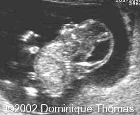 <p>What is this an image of?</p>