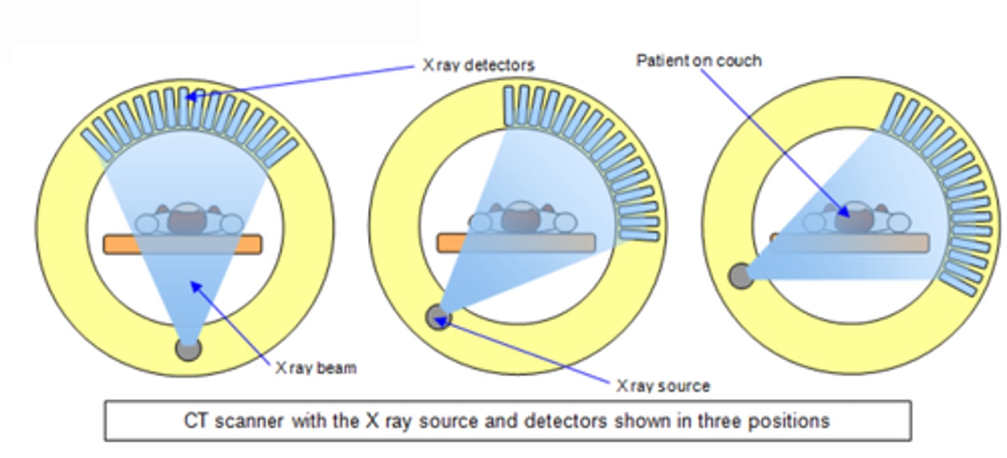 <p>Máy chụp CT - chụp cắt lớp, hiển thị hình ảnh 3D của cơ thể. (She had a CT scan after the accident - Cô ấy được chụp CT sau tai nạn.)</p>