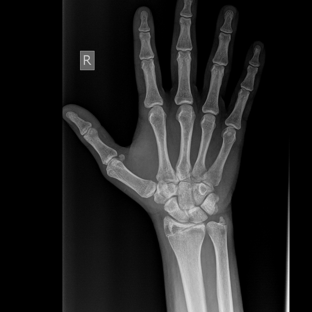 term image