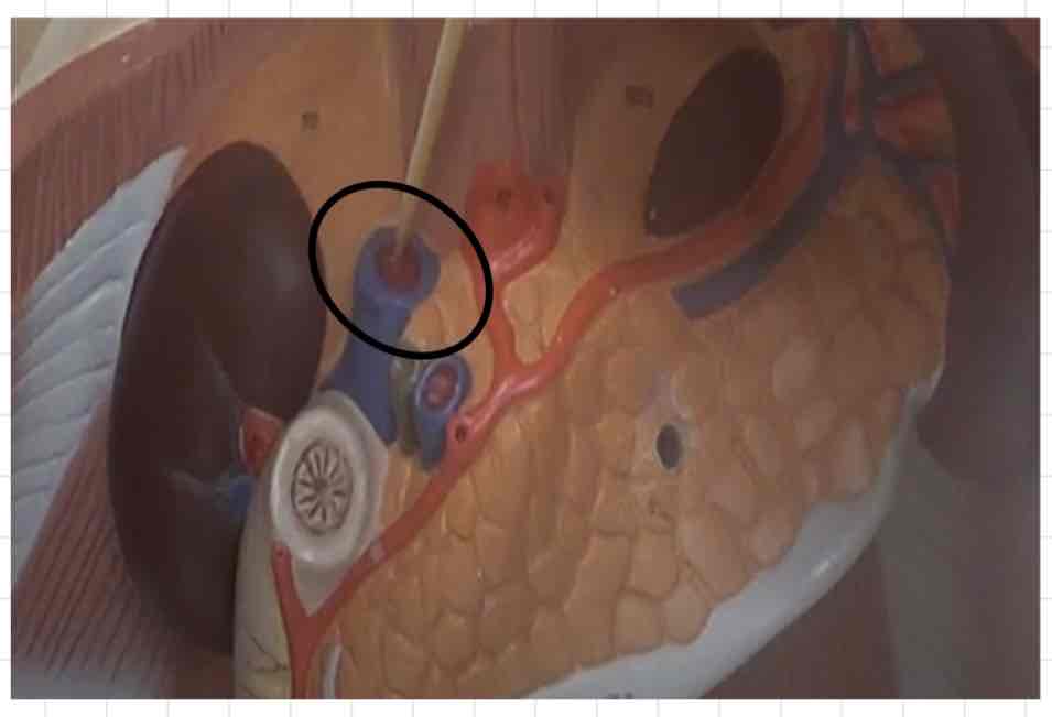 <p>what is this? (torso model)</p>