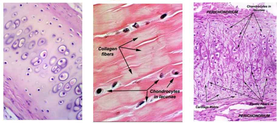 <p>What are the three major types of cartilage, and how do they differ in structure?</p>