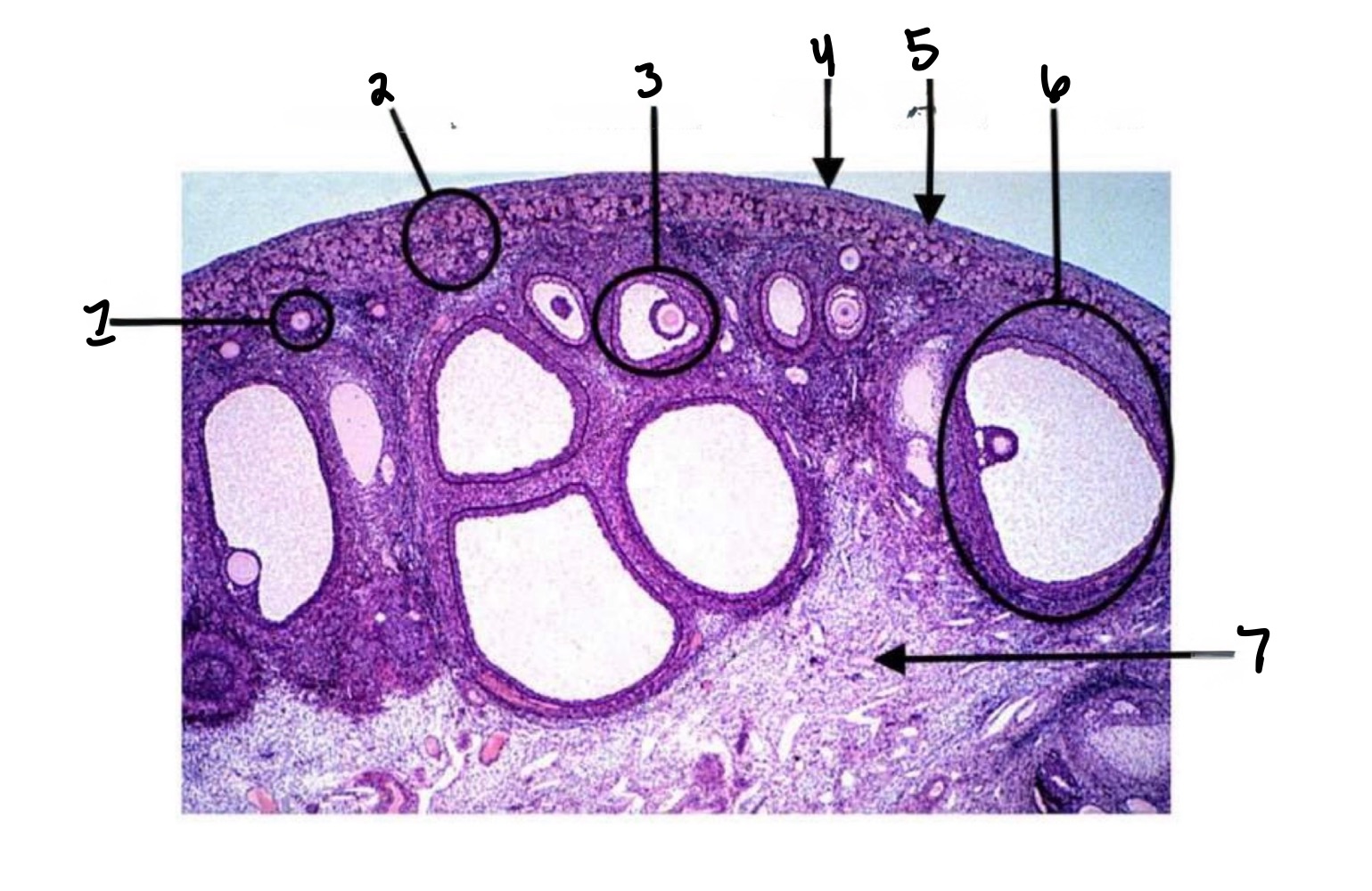 <p>Primary follicle </p>