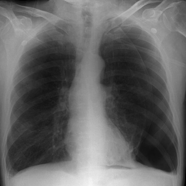 <p>Describe the abnormality demonstrated. </p>