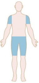 <p>Myopathy</p>
