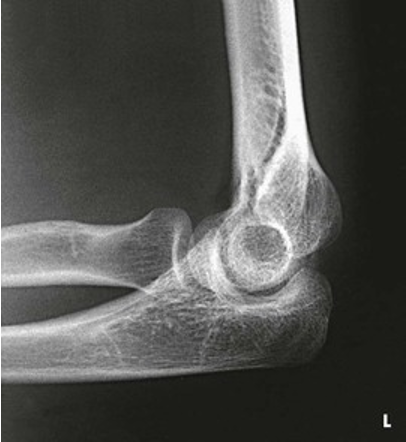 <p>What position would the hand be in for this radiograph</p>