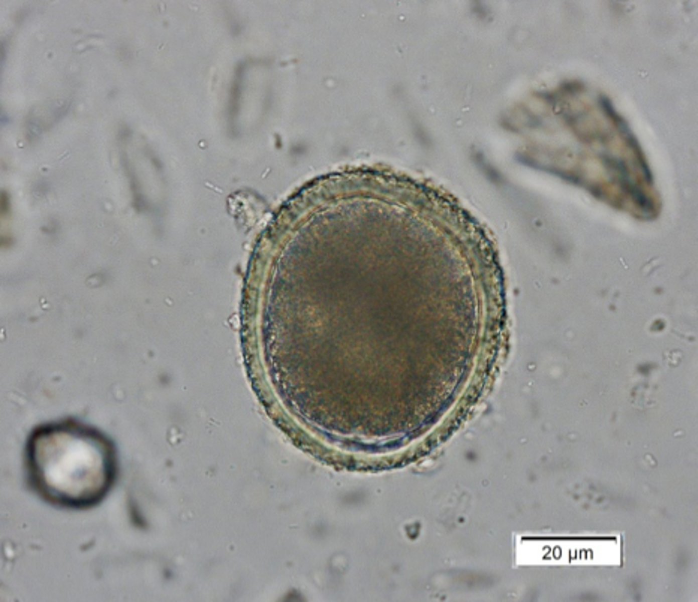 <p>What is this parasite is this if it is from a cat</p>
