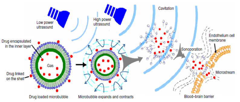 <ul><li><p>Injection of drug loaded microbubbles followed by exposure to ultrasound radiation to achieve temporarily disruption of the BBB and hence enhancing drug delivery to the brain </p></li></ul><p></p>