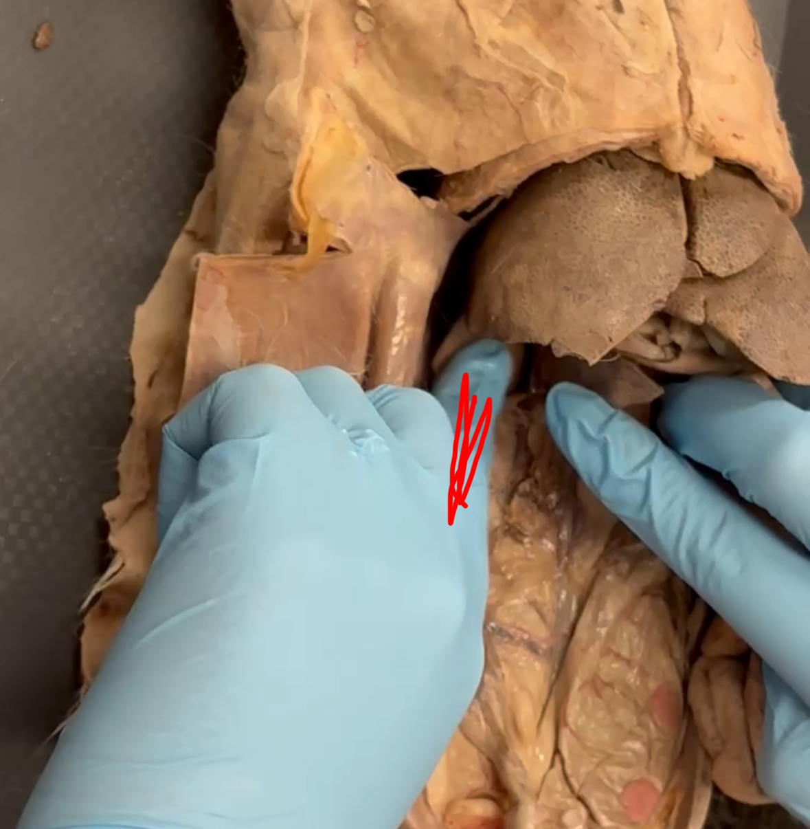 <p>Red finger is holding down which lobe</p>