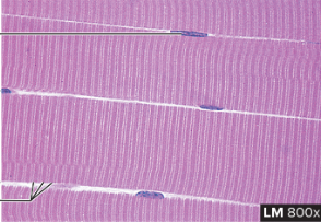 <p>what type of muscle is this</p>