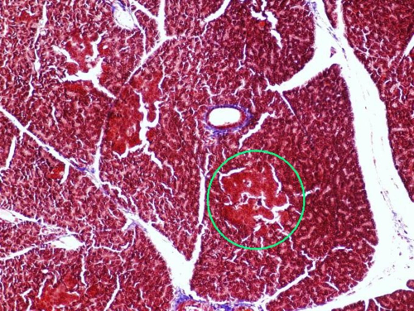 <p>name a hormone produced by the indicated region of the pancreas.</p>