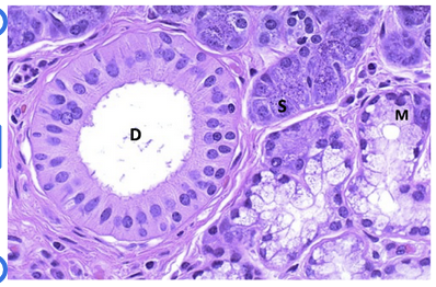 <p><span><strong>A patient reports to the office with complaints of a tender mass on the right jaw. He reports it has been slowly growing and previously did not hurt. On biopsy, the below tissue is shown (normal histology). What is the composition of the cell type(s) biopsied?&nbsp;</strong></span></p><ul><li><p><span>Mucionoid</span></p></li><li><p><span>Serous&nbsp;</span></p></li><li><p><span>Mucinous and Serous&nbsp;</span></p></li><li><p><span>None of the above</span></p></li></ul><p></p>