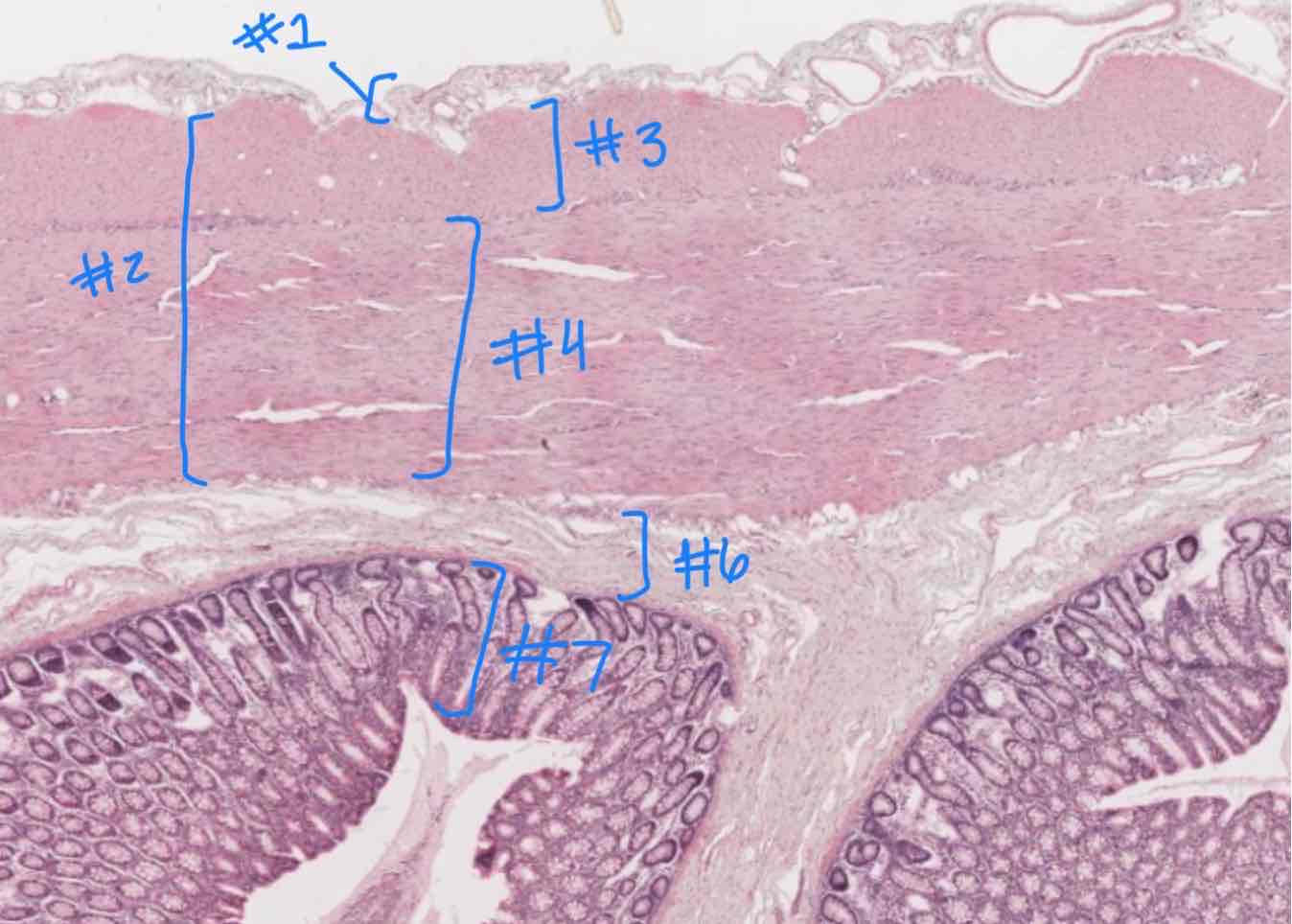 <p>What major layer is #6 indicating ?</p>