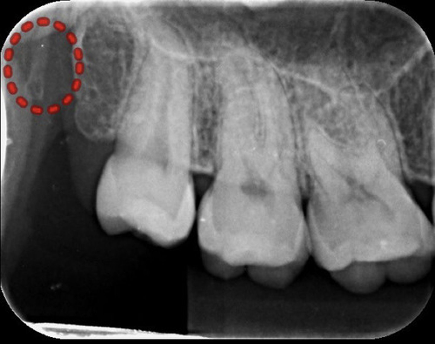 <p>What is the red dotted line circling?</p>