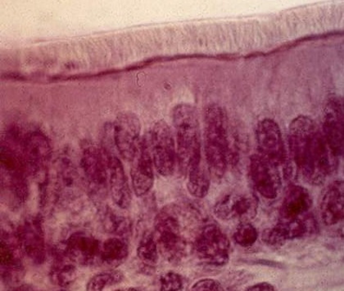 <p>Tissue with cells that appear to be in layers, but are not</p>