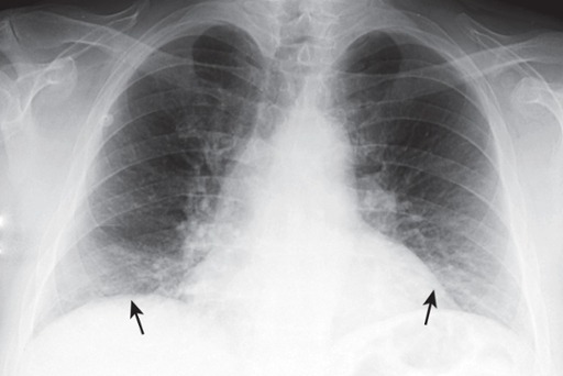 <p>Poor Inspiration</p>